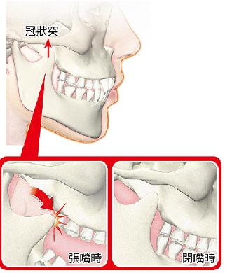 teeth2.JPG